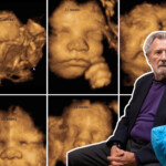 Hidden Cam Shows 86-year-old Abortionist Plotting To Terminate a Healthy 8-month-old Fetus